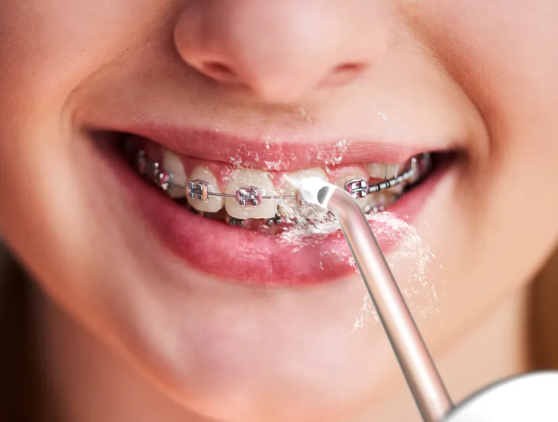 Идеально подходит для чистки брекетов