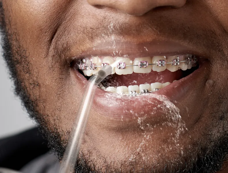 Ideálne na čistenie rovnátok