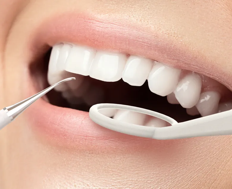 Profesjonalne czyszczenie płytki nazębnej